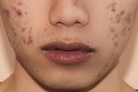 Rough skin margin-left 10px